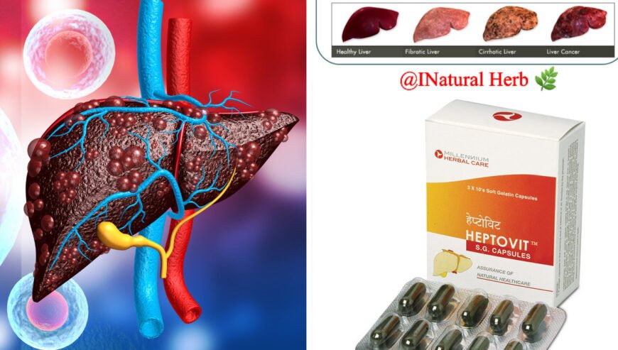 Heptovit – Millenium Herbal Care For LIVER DISFUNCTION