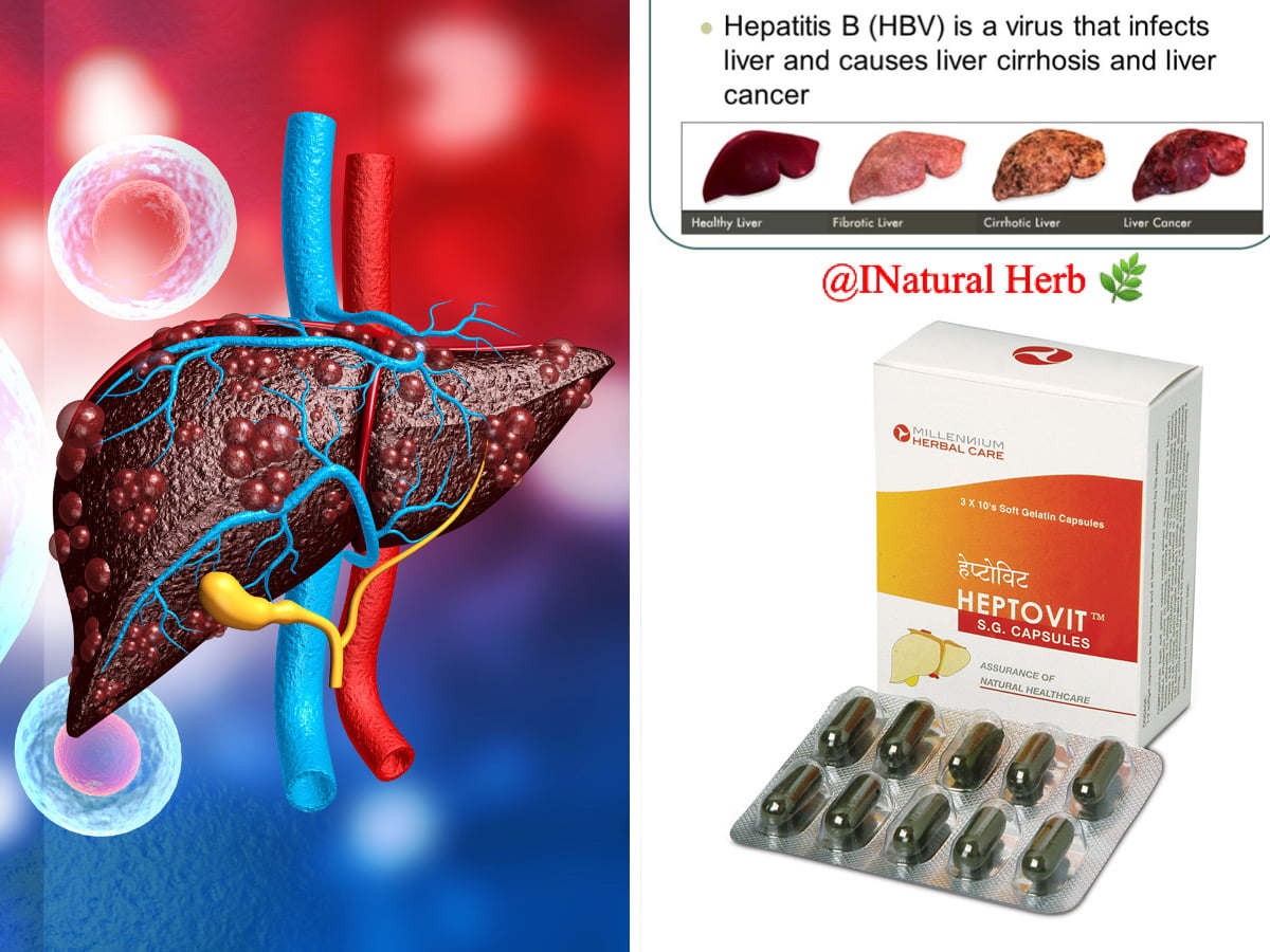 Heptovit – Millenium Herbal Care For LIVER DISFUNCTION